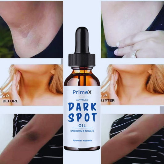 PrimeX Dark spot Intimate Area Whitening Cream Pink Body Serum - 30ml